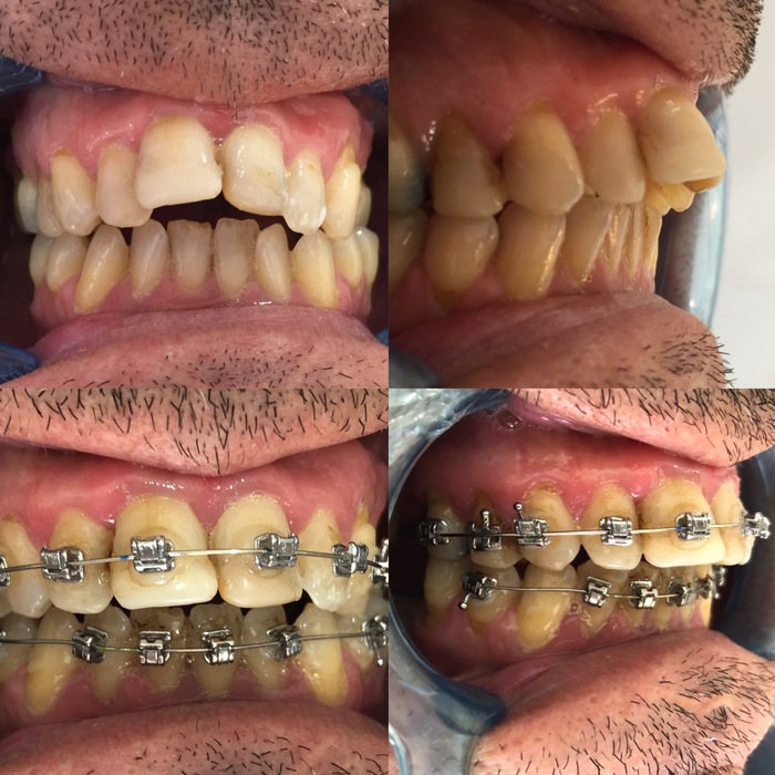 Caso clínico antes e depois