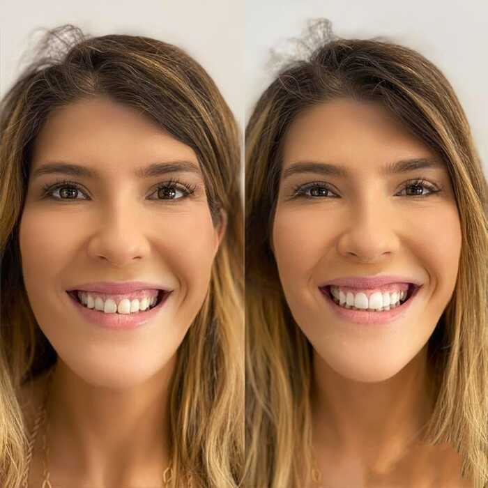 Caso clínico antes e depois