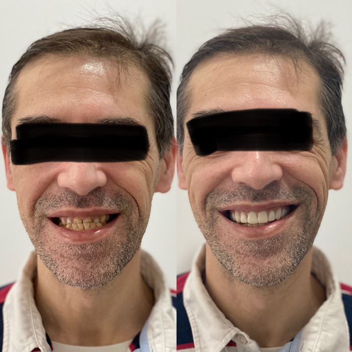 Caso clínico antes e depois