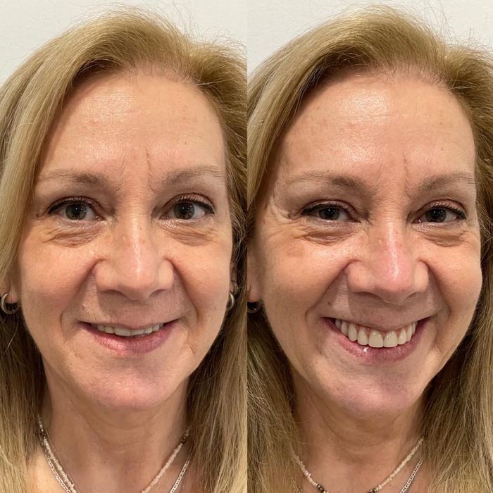 Tratamento de medicina estética facial