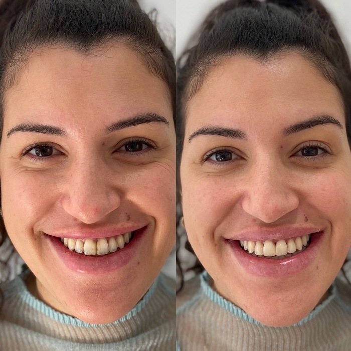 Caso clínico antes e depois