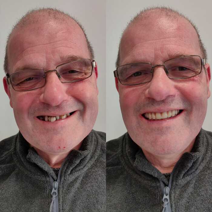 Caso clínico antes e depois