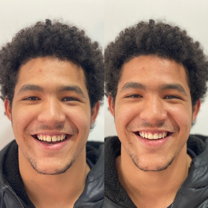 Caso clínico antes e depois