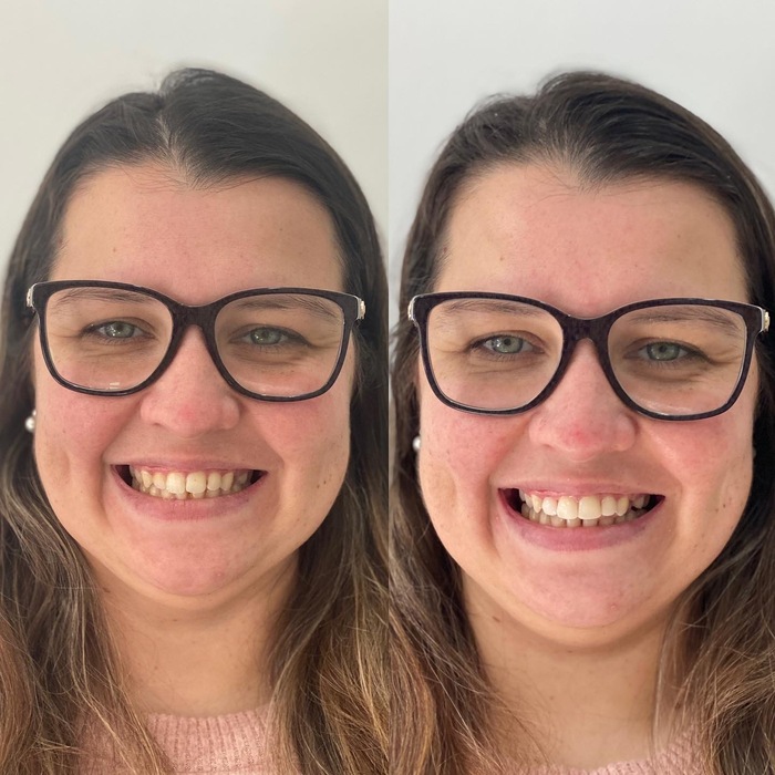 Caso clínico antes e depois