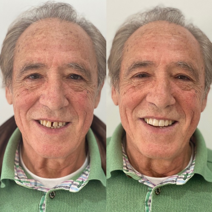 Caso clínico antes e depois