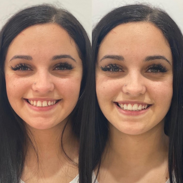 Caso clínico antes e depois