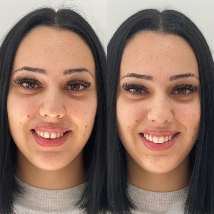 Caso clínico antes e depois