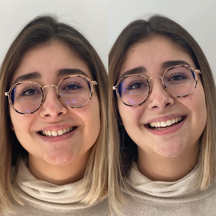 Caso clínico antes e depois