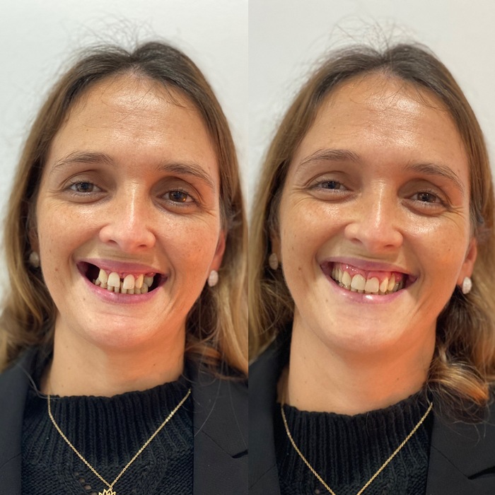 Caso clínico antes e depois