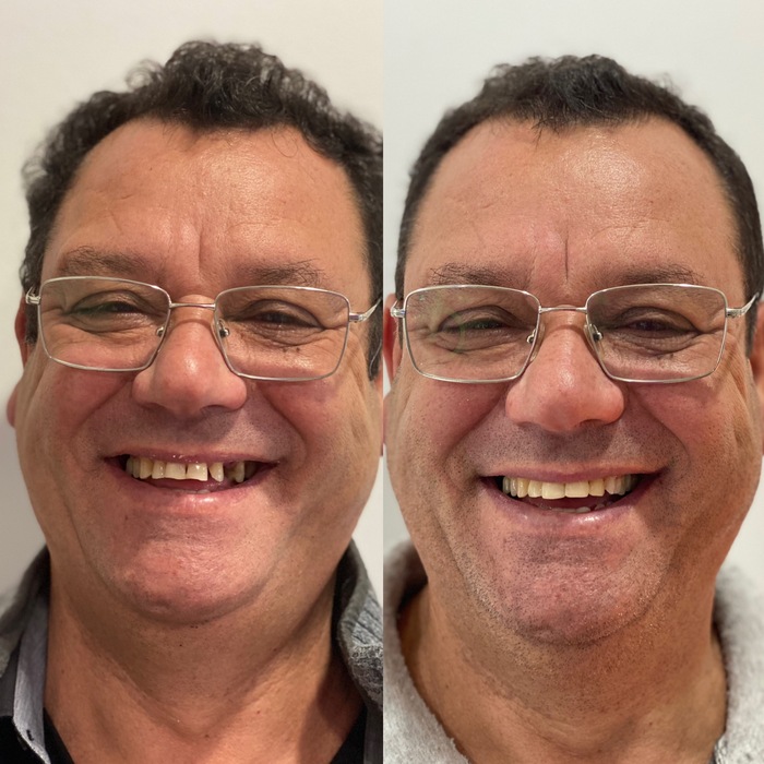 Caso clínico antes e depois