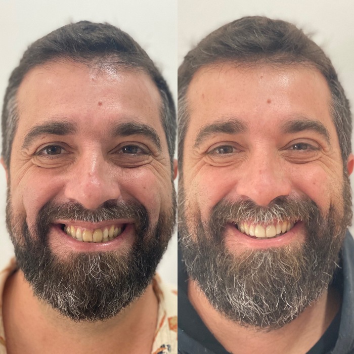 Caso clínico antes e depois