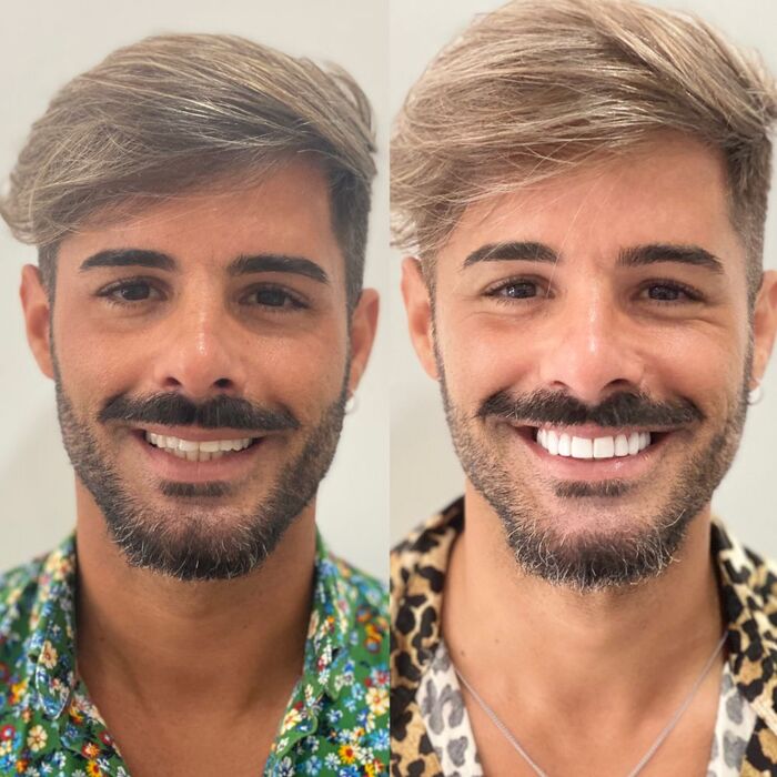 Caso clínico antes e depois